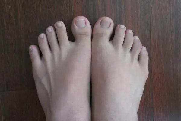 脚趾特征暗示命运,哪种形态代表富贵运 脚趾特征暗示命运,哪种形态代表富贵运